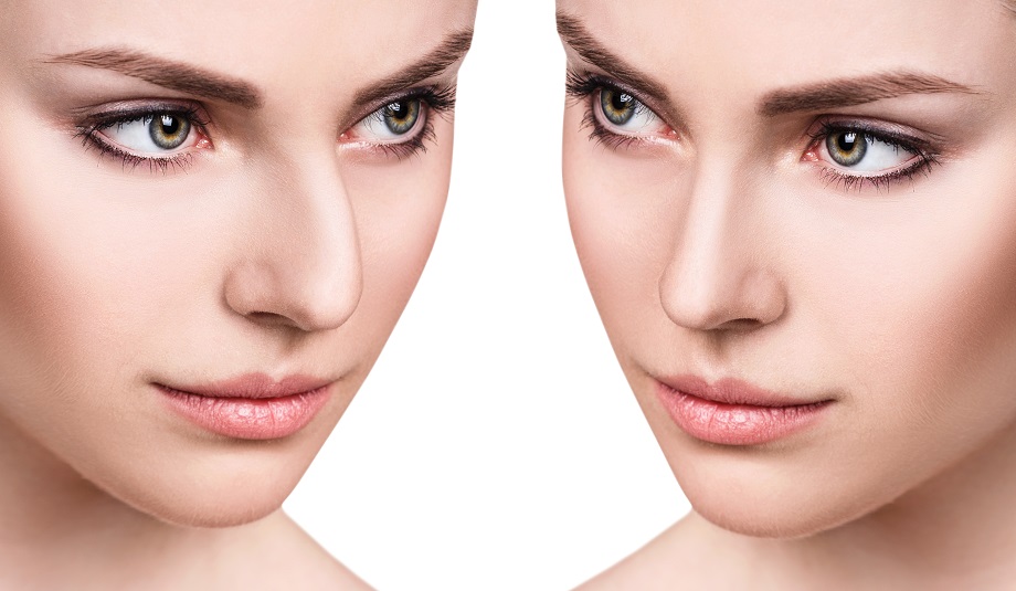 10-golden-rules-to-be-considered-after-rhinoplasty-blog1